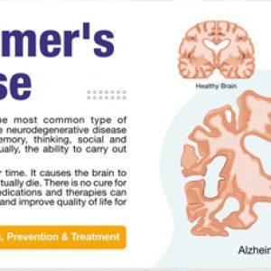 Brain would age faster and we could get Alzheimers disease, Parkinsons disease etc due to these nutrient deficiencies!!