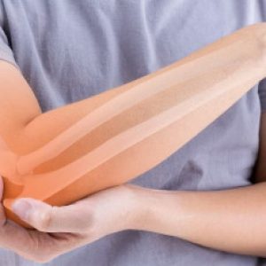 Unbelievable!! Fractures can be fixed in just 3 minutes with the help of this latest Bone Glue!!