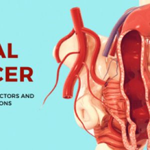 Be careful about these symptoms of anal cancer!!