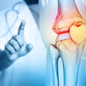 Bone Health Tips by Dr. Arun Kumar | Strengthen Your Bones Early & Prevent Joint Pain