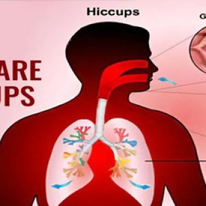 Getting hiccups or Vikkal – Their causes, remedies etc!!