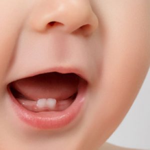 Parents must know these important things about baby teething!!